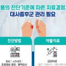 통풍 초기 원인 (손가락 관절염 발목 엄지발가락 통증) 이미지