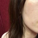 라인메디컬 | 수원 인계동 모공 탄력 메디컬오 모공리액터 볼륨리액터 대만족후기