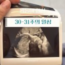(주)렉셈 정선공장 | 쌍둥이임신 30-31주 일상 | 태동검사,임신성고혈압 고위험군,관절관리,마지막 호캉스,손수건옷빨래지옥