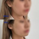 봉계2길 4, (봉방동) | 충주리프팅 웨딩관리가 필요할 땐 봉방동 한올뷰티 추천드려요