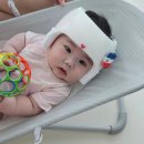 (주)지오엔테크놀로지 | 두상교정일기(4) 두상교정헬멧 착용 일상&amp; 2달 후 단두증 수치 변화 후기(+소소한 부작용)