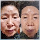 김포인셀덤보타랩운양역점 | 인셀덤 후기 - 2번째 체험