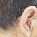 소리누리보청기 이미지