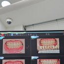 미소치과의원 | [업체 후기]화이트닝 후기_의정부환한미소치과의원_누렁니 강추