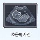 채움휴병원 | 👶🏻 &#34;휴, 한시름 놨다!&#34; 1차 기형아 검사 (NT 검사) 겪어본 솔직 후기!