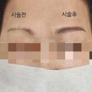 부산 덕천동 눈썹 반영구 추천 1인샵 &#39;그리다뷰티&#39; 헤어스트록 시술 후기