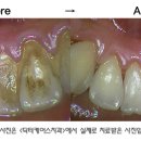 닥터케어스