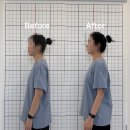 [뷰티로그] 원흥역 체형교정/마사지샵 "바로테라피"를 다녀와서💆‍♀️ | 삼송 원흥 마사지 | 거북목...