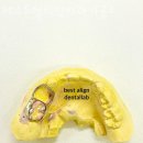 베스트 얼라인 치과기공소 이미지