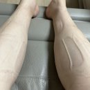 [35주]소화불량/환도선다/다리부종/임산부다리쥐/가진통/아랫배통증