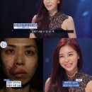 렛미인피부 이미지