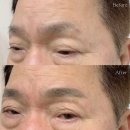 리브로우 이미지