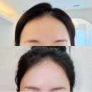 마포헤어라인문신 잘하는곳 망원동 끌로랑뷰티 반영구 헤어라인 후기