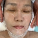 40대 기미·색소엔 트로이필! 청담스킨앤스파 피부관리 후기