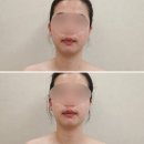여리스킨케어 | 울산 ❘ 울산 삼산동 에스테틱, 아뜰리에드스킨 LTR 스킨케어 후기 ❘ 슬로우 에이징 케어 이벤트