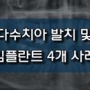 진플란트치과의원 이미지