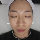 [ 부산 ] 하단 피부관리 하단기미제거 여드름 색소침착된 피부 맑게 관리 : 달리핀 에스테틱