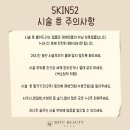 미유뷰티 / 청라튼살 흉터커버 후기
