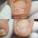 연희동네일 이미지