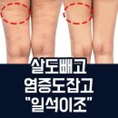 슬림 티스토리