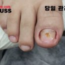 레푸스 사상점 이미지