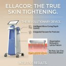 거상열처리 | [의료장비 도입] "Micro-Coring®의 실전 임상 메커니즘" 미국 FDA 승인 엘라코어 2.0(ellacor) 유튜브...