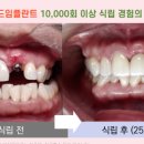 예쁜치아디자인치과기공소 이미지