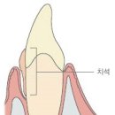 이75덴탈 이미지