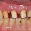 보강치과기공소 이미지