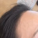 당일예약, 점심시간 퀵시술 가능한 여성전용 왁싱샵 논현역 왁싱삼공 헤어라인왁싱 후기