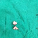 사랑니톡앤턱치과의원 이미지