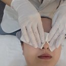 비디알(bdr)