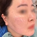백영세탁 | [수송동] 군산 피부관리, 스킨플래닝 후기 "뷰티바이로라"