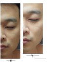 퍼지로직 이미지