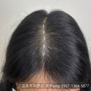 도치도트 탈모 두피케어 속눈썹 | 검단두피문신 후기 여성탈모 고민해결