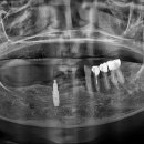 심플인플란트치과의원 이미지