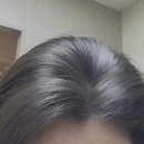 섬약국 | 니조랄샴푸 지루성두피염샴푸 가격 약국 정석 사용법 관리 후기