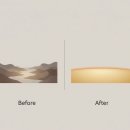 화사한외과의원 | 눈밑지방재배치 지방의 양보다 재배치하는 위치가 결과의 핵심이다