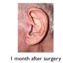 [덕계]한땀한땀 가죽공예(골프공케이스) | 안면거상 흉터 디자인 (2) - 흉을 감추는 법