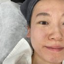 맘모스프라자 | 안산피부관리 고잔동 안산뷰티비치 모공관리 후기