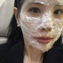 (주)디자인하암 | 스컬트라 콜라겐 주사 효과, 옆볼패임 개선, 가격 및 유지 기간, 솔직 후기