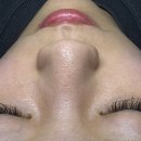 라벨르피부관리실 | 동두천피부관리 라벨르스파 세라링 후기, 블랙헤드 피지 각질 화장 뜸 고민 해결!