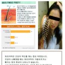 플러스모발