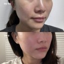 가인미가 다이어트 목동점 | 얼굴작아지는마사지 윤곽마사지로 얼굴작아지는법 가인미가 목동점 후기