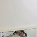 담소유 부유방 제거 수술 당일 후기 (근데 이제 앞으로의 ㅈㄴ 개 심각한 부작용을 곁들인)