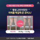 건강한다이어트 요요없는 다이어트 방법 이미지