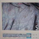 6-237 TS | 30대 여성 탈모주의! 아니 내가 원형탈모라니? - 건대탈모 웰킨두피탈모센터 건대점