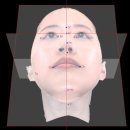 턱 비대칭 교정, 3D스캔 안면비대칭교정치료 1회 후기