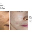 유니나 피부관리