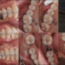 바로나치과의원 이미지